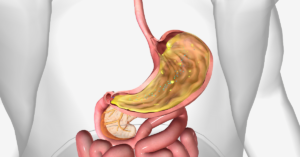 Factors That Affect Vitamin B-12 Absorption