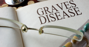 Graves’ Disease