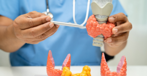 Hashimoto’s Thyroiditis
