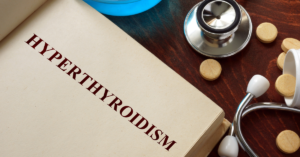 Hyperthyroidism