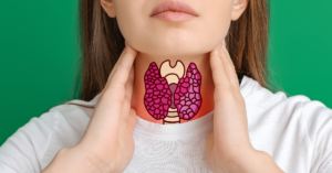 Thyroid Nodules