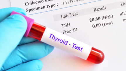 "Hypothyroidism vs. Hyperthyroidism: Must-Know Differences for Better Health"