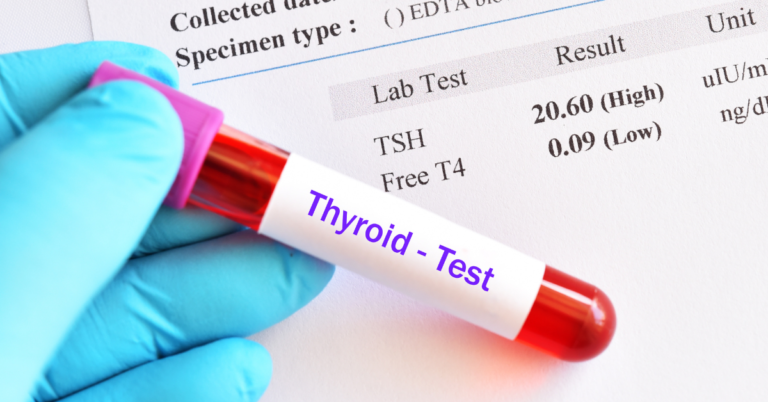 "Hypothyroidism vs. Hyperthyroidism: Must-Know Differences for Better Health"