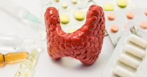  Hypothyroidism 