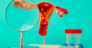 Ovarian Changes 